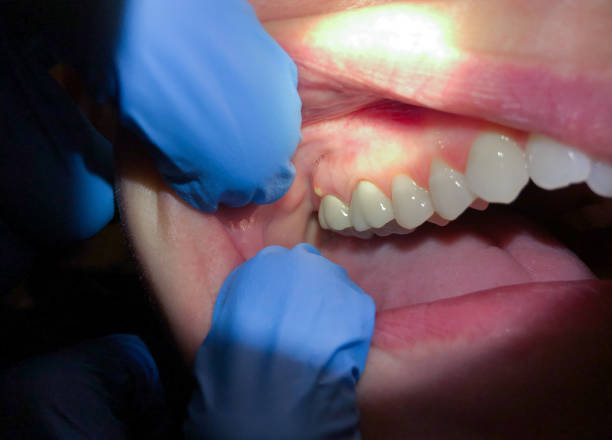 Best Walk-In Emergency Dentist in Louisa, KY